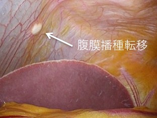 4. 検査