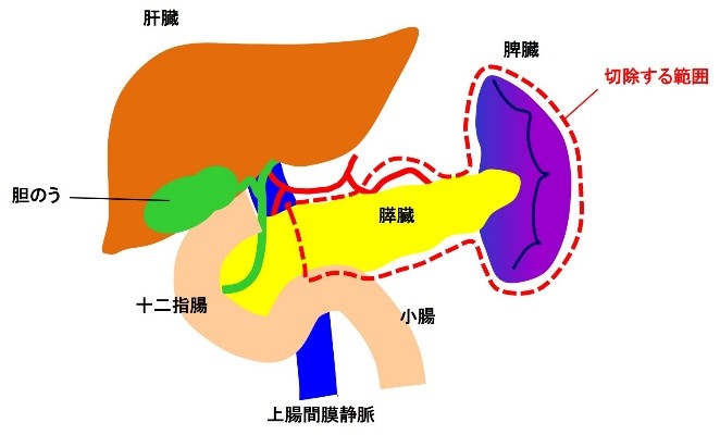 (図3)